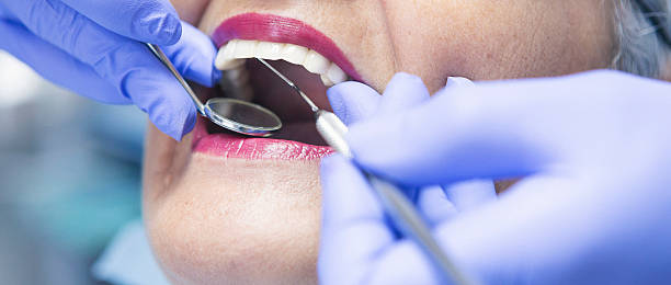Best Emergency Cosmetic Dentistry in Yorkville, NY